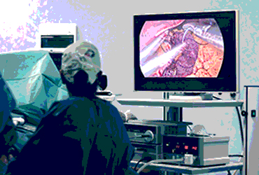 bariatric surgery