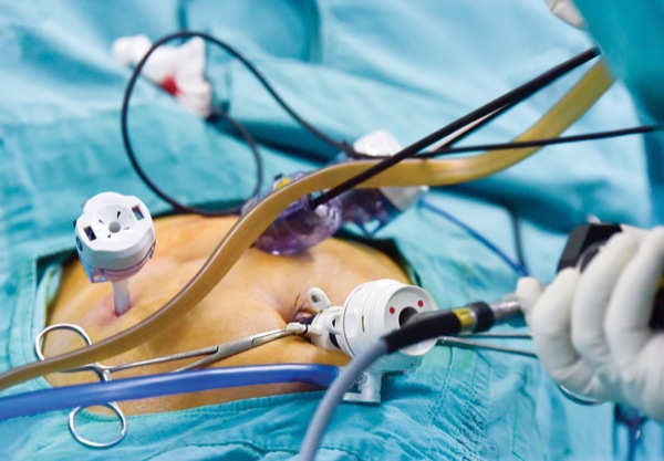 Preference Card Review Produces Surprising Savings in Lap Chole