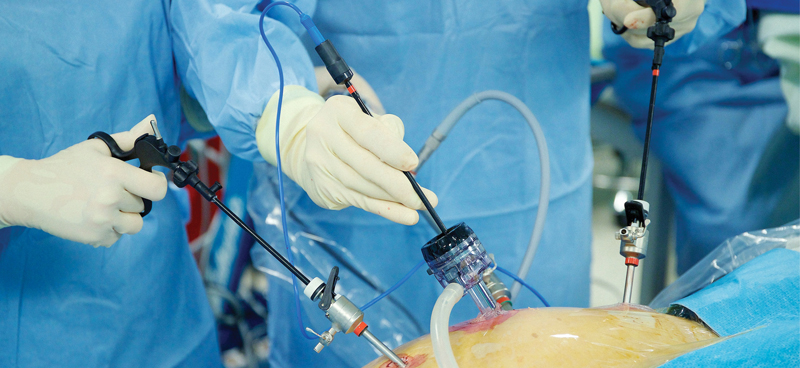 Antibiotics Appendectomy Interval Appendicitis