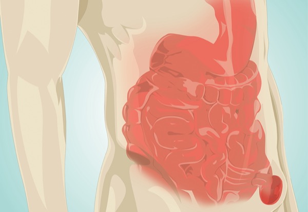 Herniology Debates Robotic Surgery