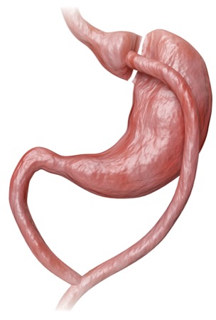 glp 1 patches reviews for weight loss GLP-1 Patches Vs GLP-1 Injections: Which Is Better For Weight Loss?