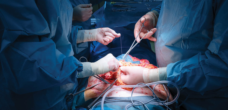 Hernia Surgery - Shutterstock